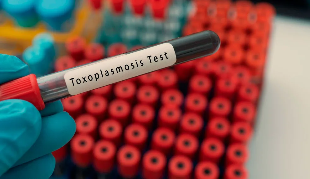 Toxoplasmosis. Toxoplasma gondii: el inquilino silencioso